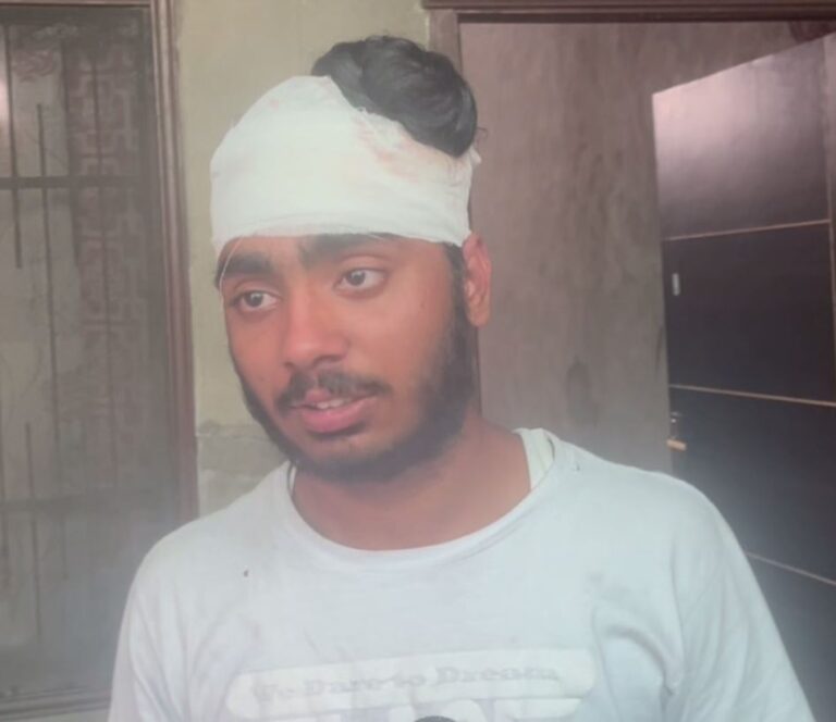 ਅੰਮ੍ਰਿਤਸਰ ਦੇ ਰਾਮਨਗਰ ਇਲਾਕੇ ’ਚ ਚਲੀ ਗੋਲੀ/ ਰੰਜ਼ਿਸ਼ ਦੇ ਚਲਦਿਆਂ ਨੌਜਵਾਨਾਂ ਨੂੰ ਬਣਾਇਆ ਨਿਸ਼ਾਨਾ/ ਘਟਨਾ ਸੀਸੀਟੀਵੀ ’ਚ ਕੈਦ, ਪੁਲਿਸ ਕਰ ਰਹੀ ਜਾਂਚ