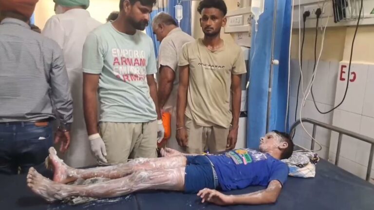 ਬਟਾਲਾ ’ਚ ਗੈਸ ਪਾਈਪ ਫਟਣ ਕਾਰਨ ਚਾਰ ਜ਼ਖਮੀ; ਇੰਟਰਨੈੱਟ ਤਾਰਾਂ ਪਾਉਣ ਦੌਰਾਨ ਵਾਪਰਿਆ ਹਾਦਸਾ; ਧਰਤੀ ਹੇਠਾਂ ਵਿੱਛੀ ਗੈਸ ਪਾਈਪ ਲਾਈਨ ਨੂੰ ਲੱਗੀ ਅੱਗ