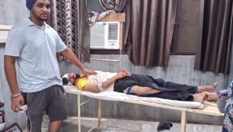 ਸਮਰਾਲਾ ਨੇੜੇ ਨਵ-ਵਿਆਹੇ ਜੋੜੇ ਨੂੰ ਕਾਰ ਨੇ ਮਾਰੀ ਟੱਕਰ/ ਪਤੀ ਦੀ ਟੁੱਟੀ ਲੱਤ, ਪਤਨੀ ਗੰਭੀਰ ਜ਼ਖਮੀ/ ਘਟਨਾ ਸੀਸੀਟੀਵੀ ’ਚ ਕੈਦ, ਪੁਲਿਸ ਕਰ ਰਹੀ ਜਾਂਚ