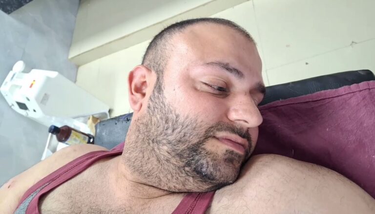 ਹੁਸ਼ਿਆਰਪੁਰ ’ਚ ਕੁੱਤੇ ਦੇ ਹਮਲੇ ’ਚ ਵਿਅਕਤੀ ਜ਼ਖਮੀ; ਡੋਗ ਫਾਰਮ ’ਚ ਕਤੂਰਾ ਦੇਖਣ ਜਾਣਾ ਪਿਆ ਮਹਿੰਗਾ;  ਲਗਵਾਉਣੇ ਪਏ ਟਾਂਕੇ, ਹਾਲਤ ਸਥਿਰ