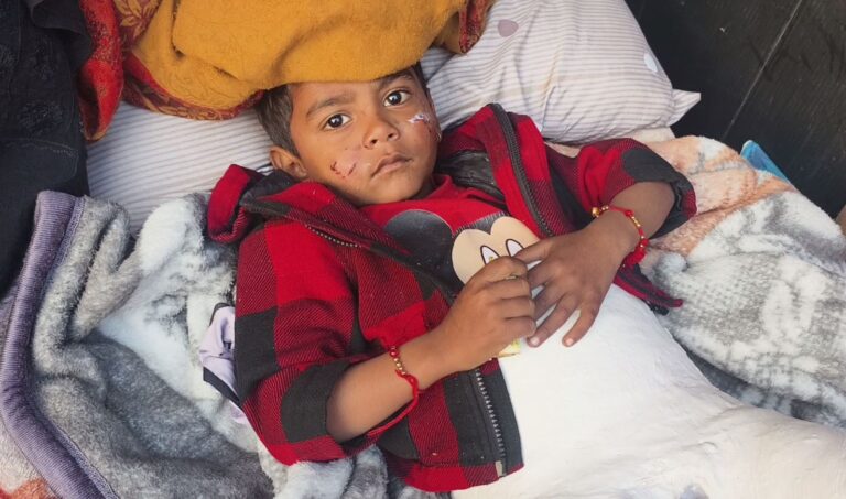 ਸੰਗਰੂਰ ’ਚ ਅਵਾਰਾ ਕੁੱਤਿਆਂ ਦੀ ਦਹਿਸ਼ਤ/ ਚਾਰ ਸਾਲਾ ਬੱਚੇ ਨੂੰ ਬਣਾਇਆ ਨਿਸ਼ਾਨਾ/ ਕੁੱਝ ਦਿਨ ਪਹਿਲਾਂ ਮਹਿਲਾ ਤੇ ਕੀਤਾ ਸੀ ਹਮਲਾ