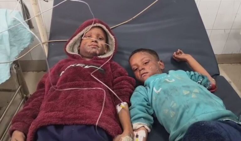 ਲੁਧਿਆਣਾ ’ਚ ਅੱਗ ਨਾਲ ਝੁਲਸੇ 3 ਬੱਚੇ/ ਗੈਸ ਸਿਲੰਡਰ ਦੀ ਰੀਫਿੰਲਿਗ ਦੌਰਾਨ ਭੜਕੀ ਅੱਗ